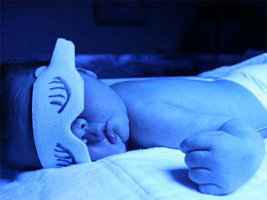 新生兒光療